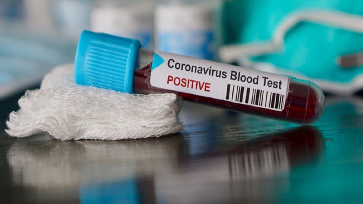 coronavirus test positive