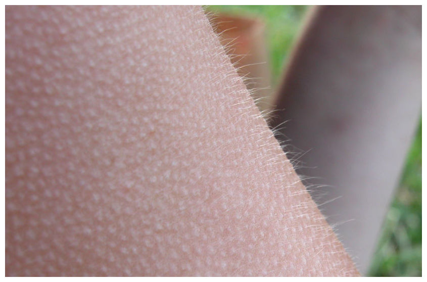 the-real-reason-behind-goosebumps-neuroscience-news