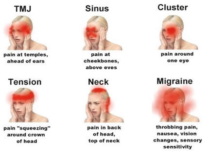 The signs and symptoms of 6 different types of headaches -- Health