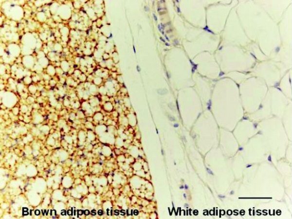 researchers-use-experimental-drug-to-convert-white-fat-into-calorie