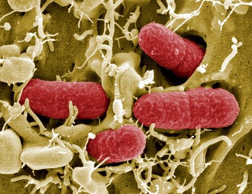 research-suggests-modified-bacteria-related-to-lethal-hospital-superbug