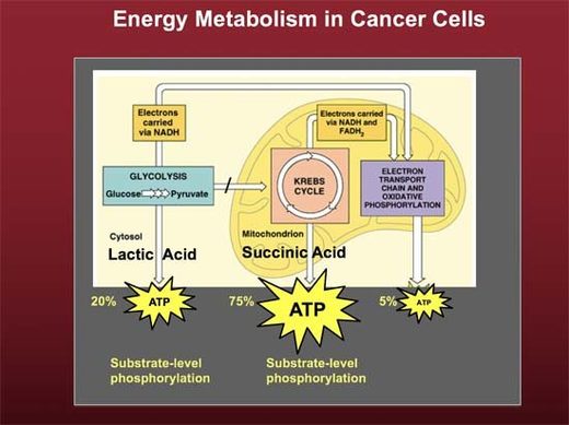 Why cancer needs to be treated as a metabolic disease -- Health