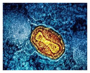 Monkeypox virus