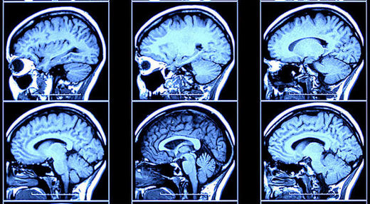 Criminal minds are different from yours, brain scans show -- Science of ...